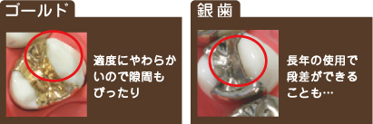 �S�[���h�Ƌ⎕